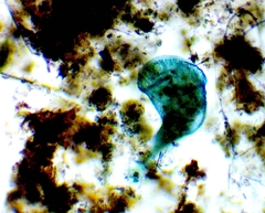 Stentor coeruleus