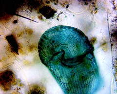 Stentor coeruleus