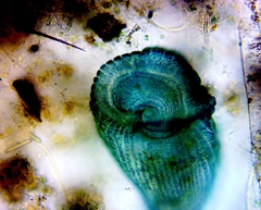Stentor coeruleus