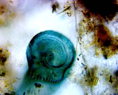 Stentor coeruleus