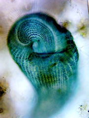 Stentor coeruleus