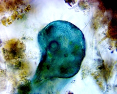 Stentor coeruleus