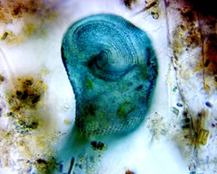 Stentor coeruleus