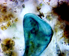 Stentor coeruleus