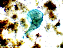 Stentor coeruleus