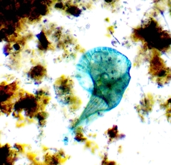 Stentor coeruleus