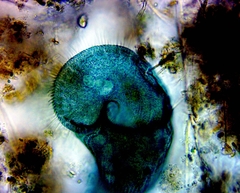 Stentor coeruleus