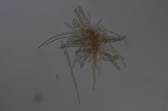 Pseudocercospora rhinacanthi