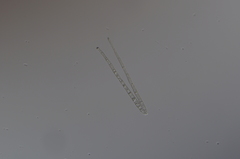 Pseudocercospora rhinacanthi