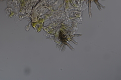 Pseudocercospora rhinacanthi