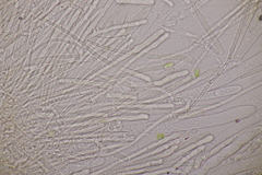 Lachnellula occidentalis