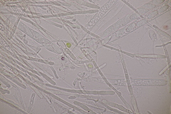 Lachnellula occidentalis