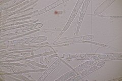 Lachnellula occidentalis