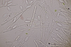 Lachnellula occidentalis