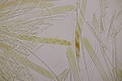 Lachnellula occidentalis