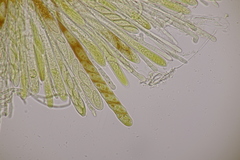 Lachnellula occidentalis