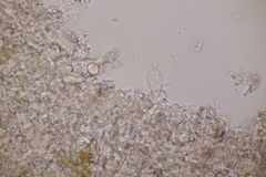 Aleurodiscus aurantius