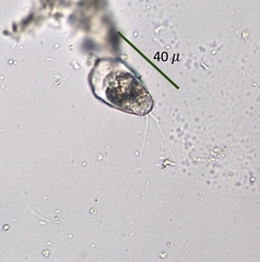 Cercozoa