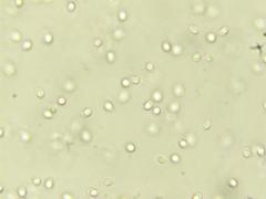 Tricholoma manzanitae