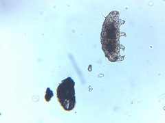 Heterotardigrada