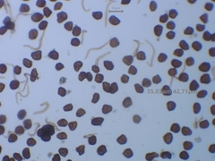 Fossombronia pusilla