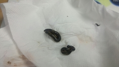 Anaulaciulus koreanus