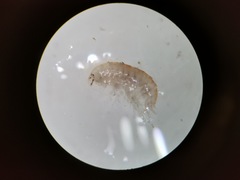 Hyalella azteca
