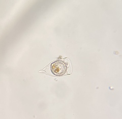 Favella