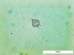 Protoperidinium