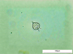Protoperidinium