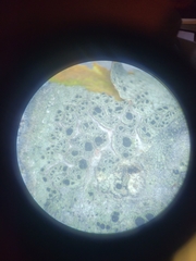 Amandinea dakotensis