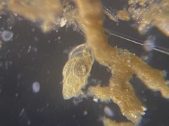 Uvigerina