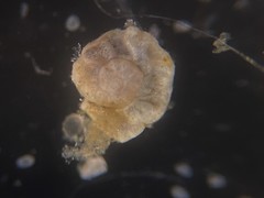 Cibicides advenum