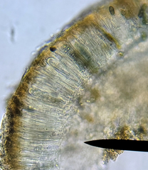 Rinodina pachysperma