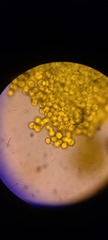 Corallococcus