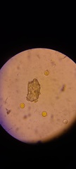 Corallococcus