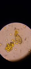 Corallococcus