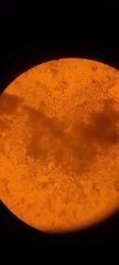 Corallococcus