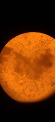 Corallococcus