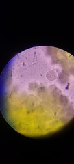 Corallococcus