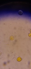 Corallococcus