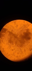 Corallococcus