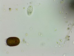 Trachelomonas armata