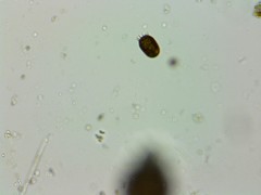 Trachelomonas armata