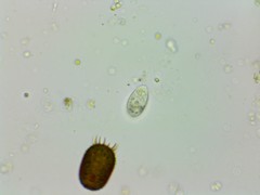 Trachelomonas armata