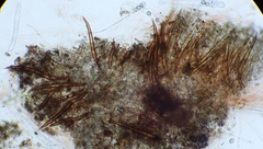 Scutellinia nigrohirtula