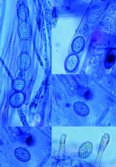 Scutellinia nigrohirtula
