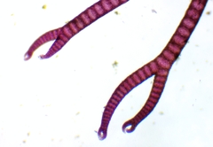 Ceramium virgatum