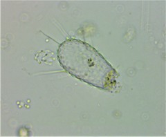 Euglypha acanthophora