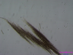 Aphanizomenon